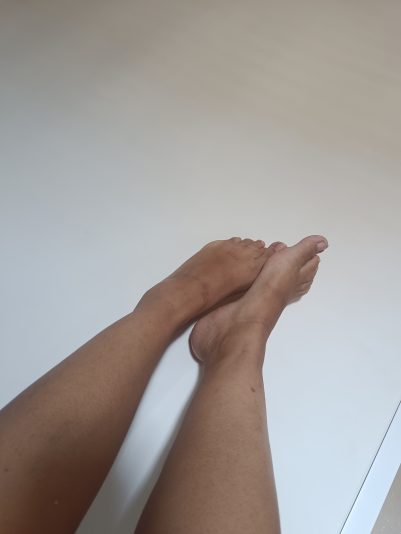 1000140379